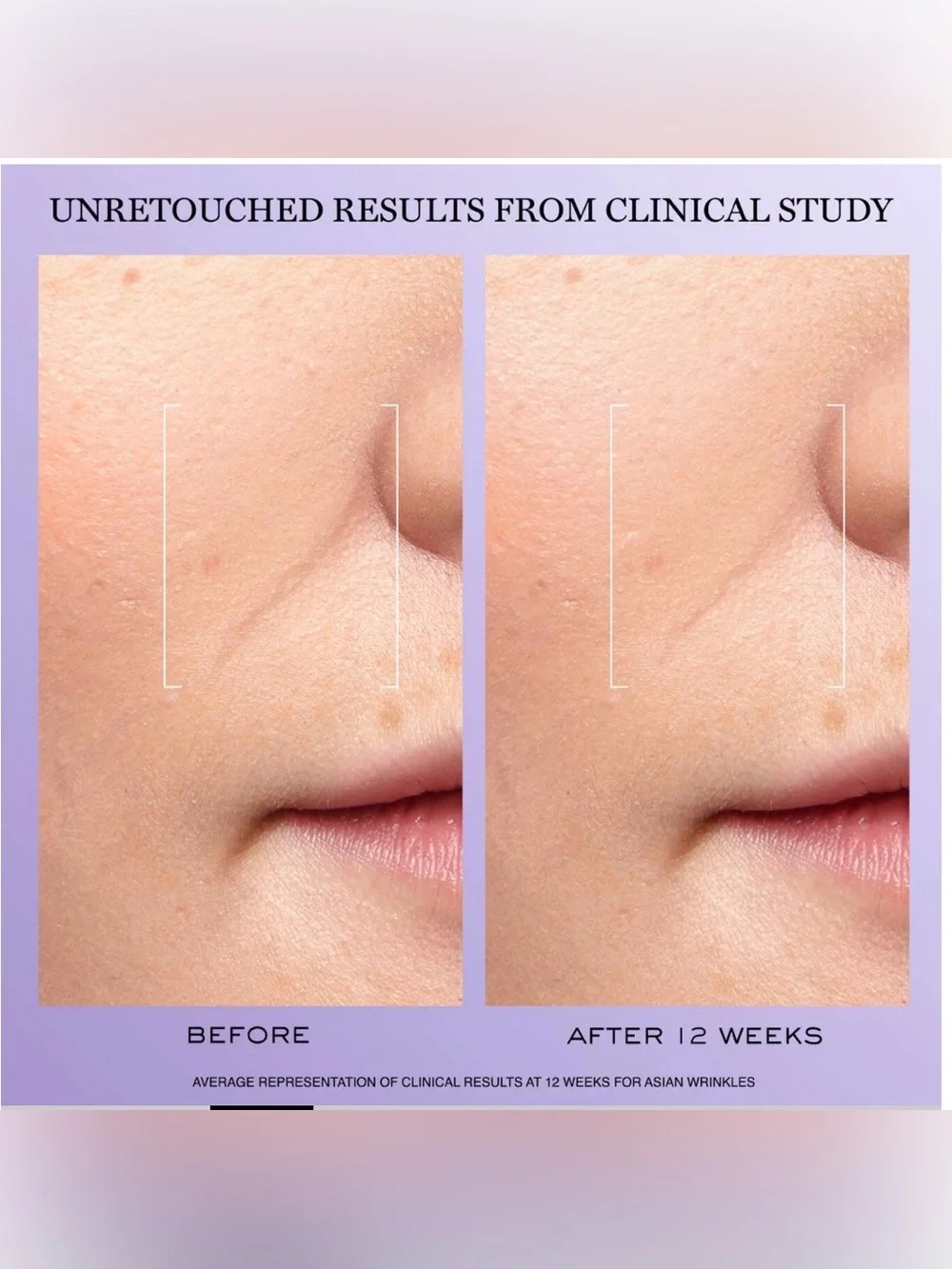 Lancôme Renergie HCF Triple Serum Plumping & Dark Spot Reducing